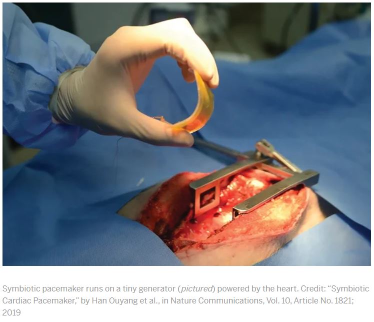 Scientific American Heartbeat-Powered Pacemaker