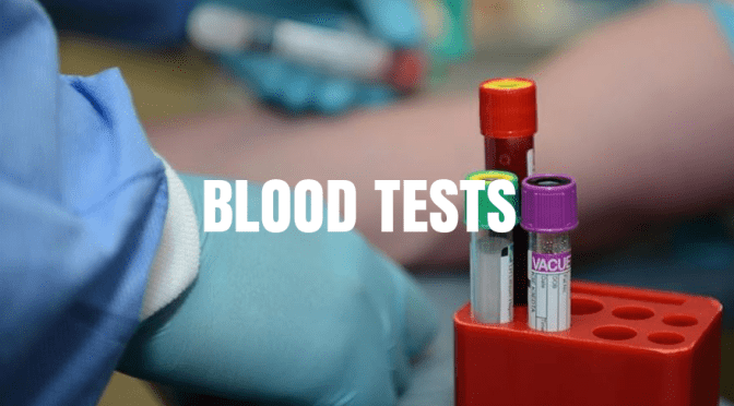 Boomers Health: Fasting Before Blood Tests For Cholesterol Is Not Necessary Study Finds