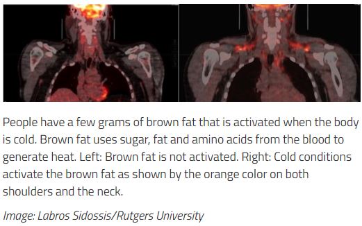 Rutgers Brown Fat Study
