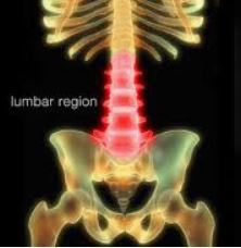 Chronic Lower Back Pain