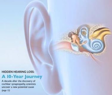 Hearing Loss