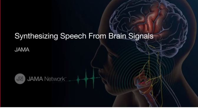 Medical Research Video: “Synthesizing Speech From Brain Signals” (JAMA)