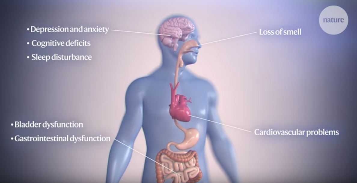 Understanding Parkinson's Disease Nature Neuroscience Videos Dec 16 2019