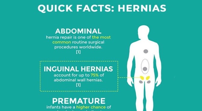 Health: “What Are Hernias & How Are They Repaired?”