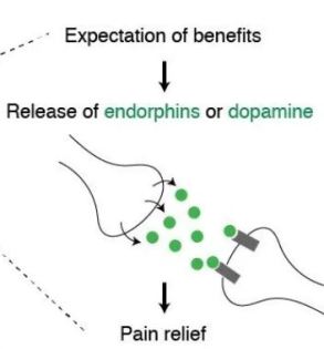 Placebo Expectation of Benefits
