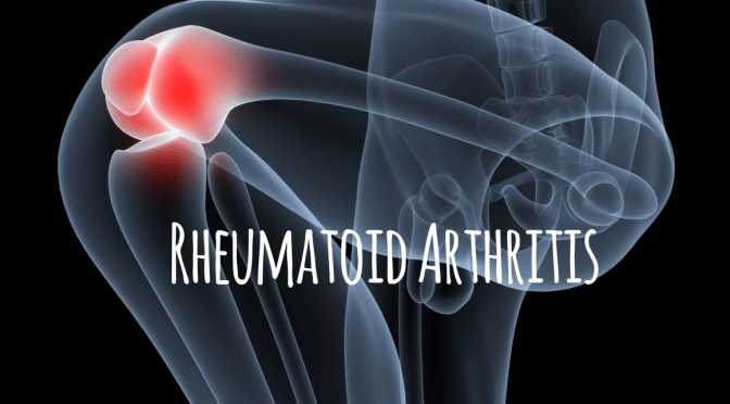 Research: Scientists Find Protein To Regulate Immune Attacks, Reduce Rheumatoid Arthritis