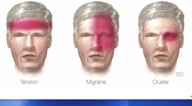 Medical Podcast: “Tension Headache” Can Be Episodic Or Chronic (The BMJ)