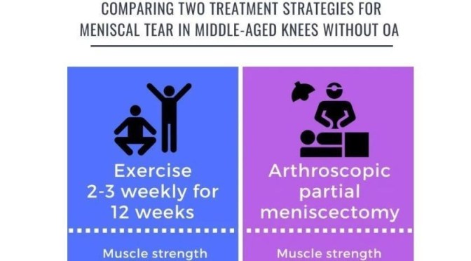 Study: Middle-Aged Knees With Meniscal Tears – No Benefits To Surgery Over Exercise Therapy (BMJ)