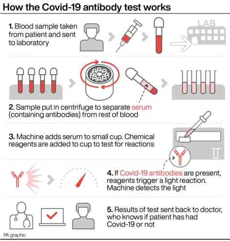 Infographic - How The Covid-19 Antibody Test Works