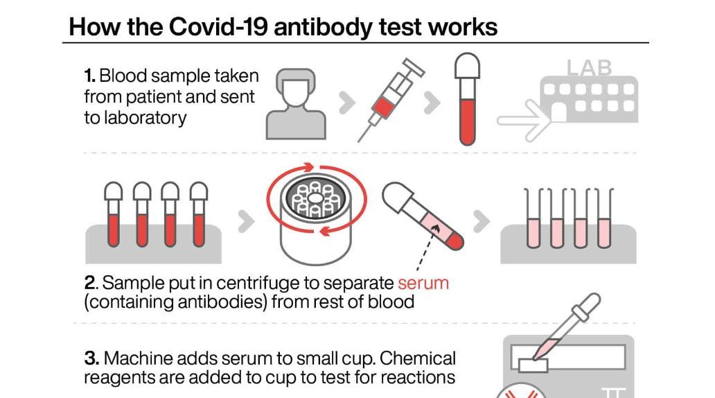 Health: “How The Covid-19 Antibody Test Works” | Boomers Daily
