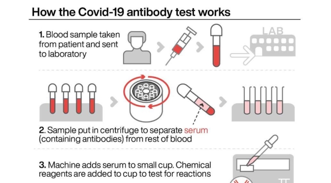 Health: “How The Covid-19 Antibody Test Works”