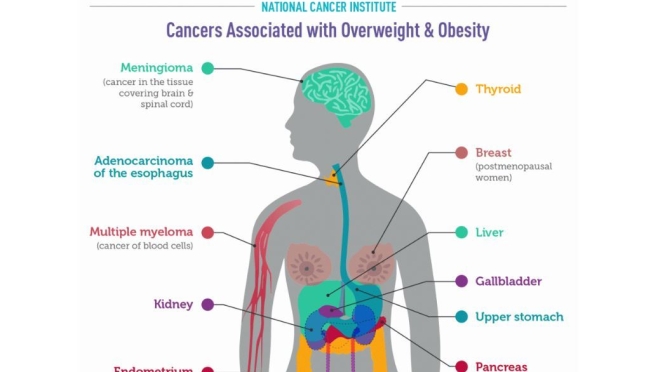 Health Infographics: “Cancers Associated With Overweight & Obesity”