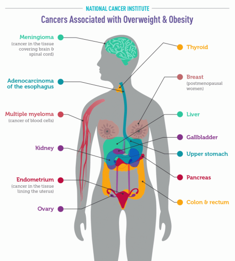 Cancers Assoicated with Overweight and Obesity - National Cancer Institute - Infographic