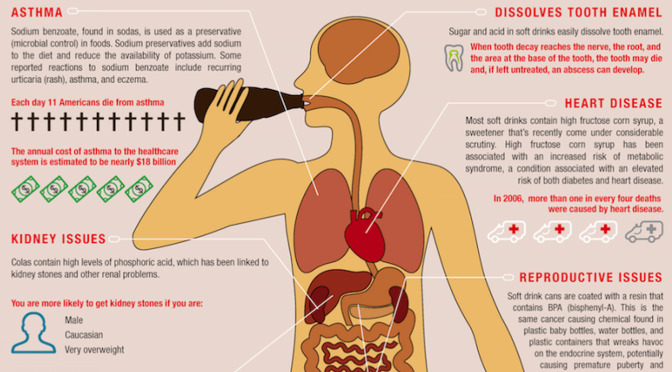 Infographics: Unhealthy Impact Of Drinking Soda