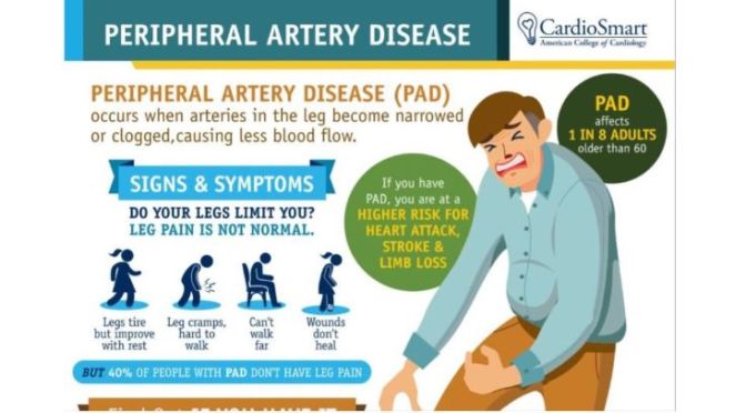 Health Infographics: ‘Peripheral Artery Disease’