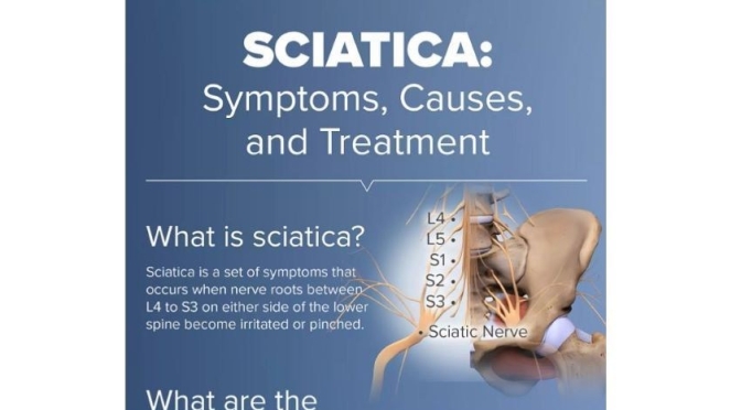 Infographic: “Sciatica –  Symptoms & Treatment”