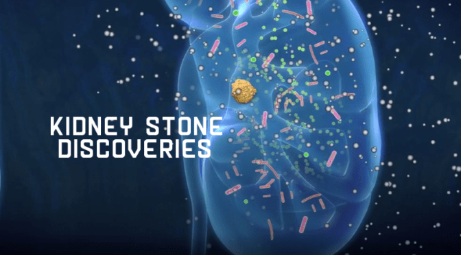 Health: New Discoveries In Kidney Stones Treatment