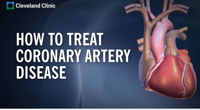 Medicine: How To Treat Coronary Heart Disease