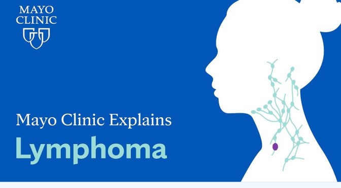 Medicine: The Mayo Clinic Explains Lymphoma (Video)