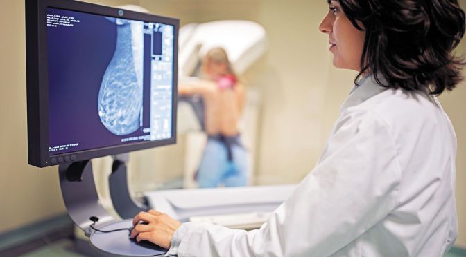 Women’s Health: How Mammograms Can Reveal Cardiovascular Disease